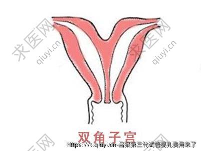 吕梁第三代试管婴儿费用来了
