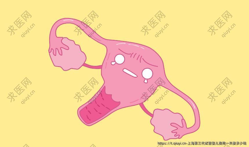 上海第三代试管婴儿费用一共要多少钱
