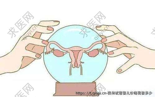 扬州试管婴儿价格需要多少
