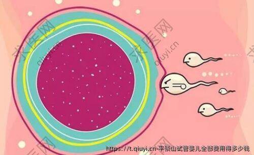 平顶山试管婴儿全部费用得多少钱