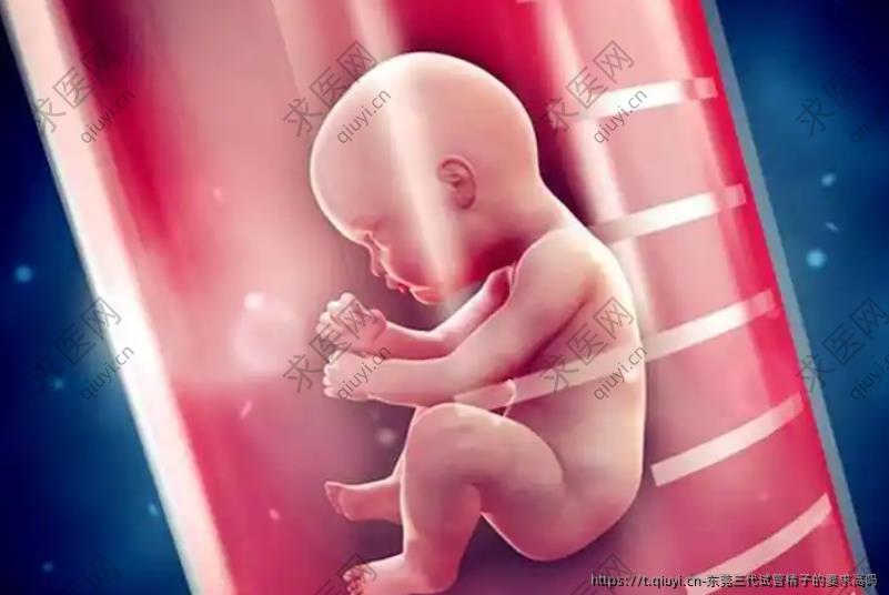 东莞三代试管精子的要求高吗