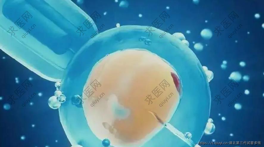 湖北第三代试管多钱