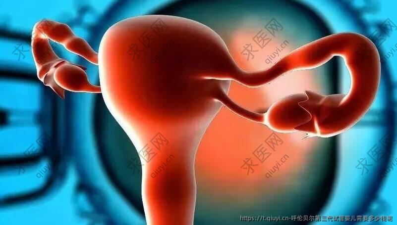 呼伦贝尔第三代试管婴儿需要多少钱呢