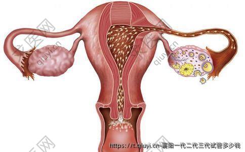 襄阳一代二代三代试管多少钱