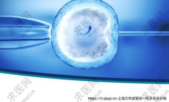 上海三代试管比一代多花多少钱