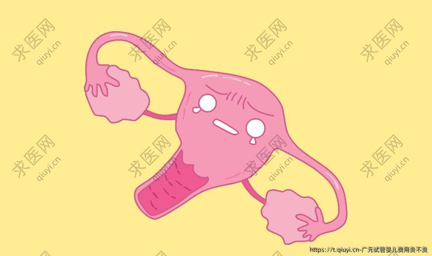 广元试管婴儿费用贵不贵