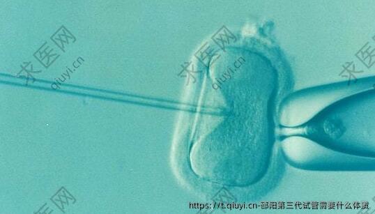 邵阳第三代试管需要什么体质