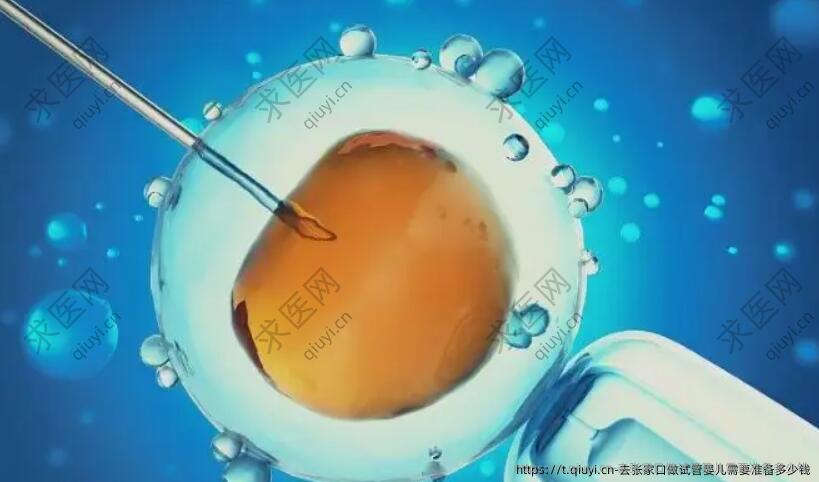 去张家口做试管婴儿需要准备多少钱