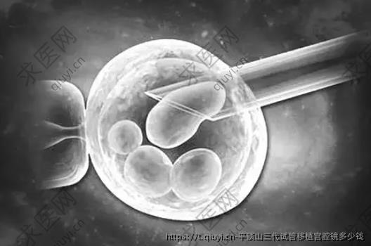 平顶山三代试管移植宫腔镜多少钱