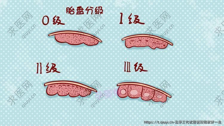 云浮三代试管医院哪家好一点