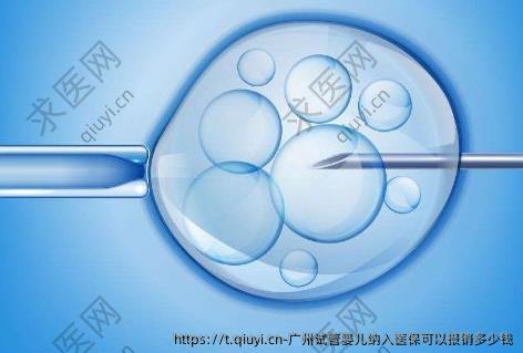 广州试管婴儿纳入医保可以报销多少钱